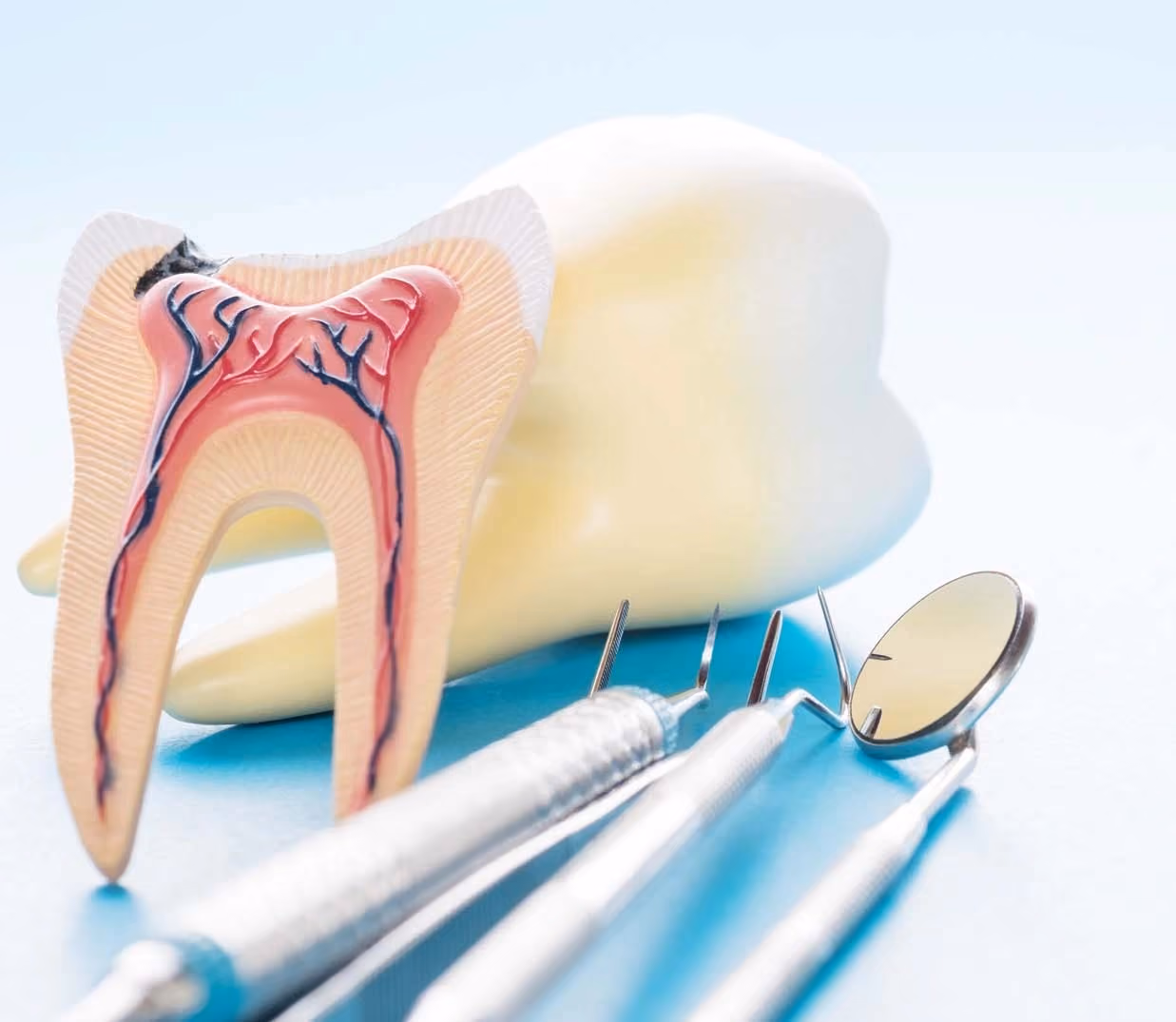 Advanced Endodontics: When a Root Canal Needs Post and Core Restoration