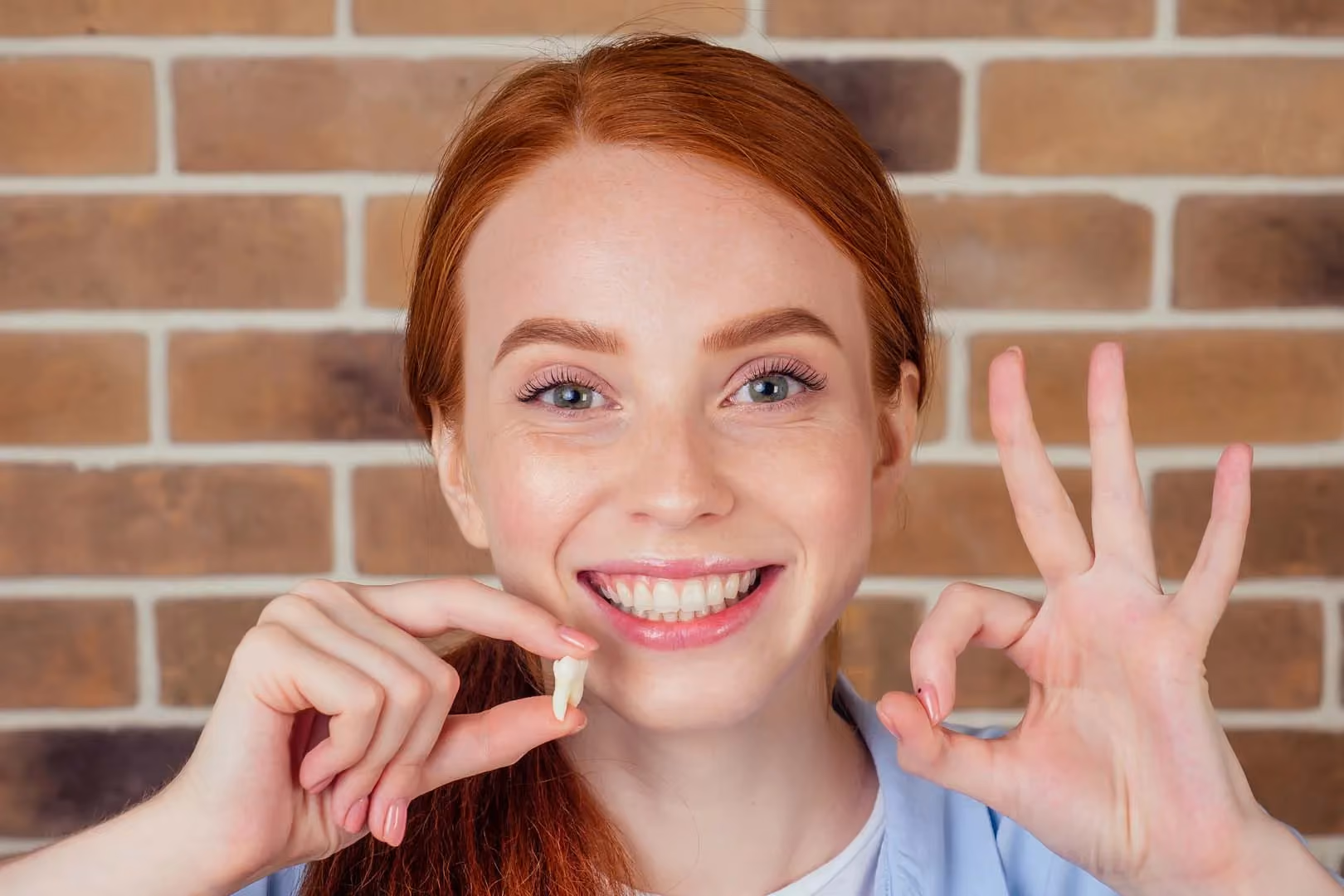 Do You Need Your Wisdom Teeth Removed? Signs to Watch For