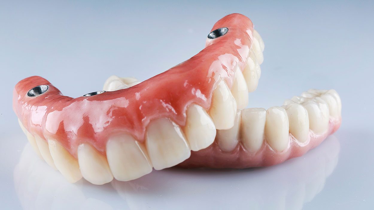 implant-retained dentures Freehold dentist