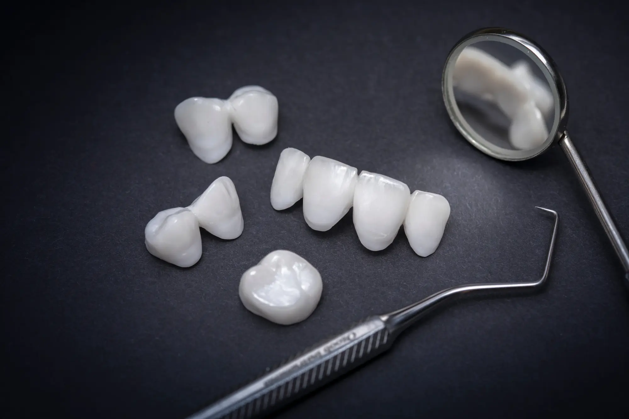 Premier Arts Dental - veneers