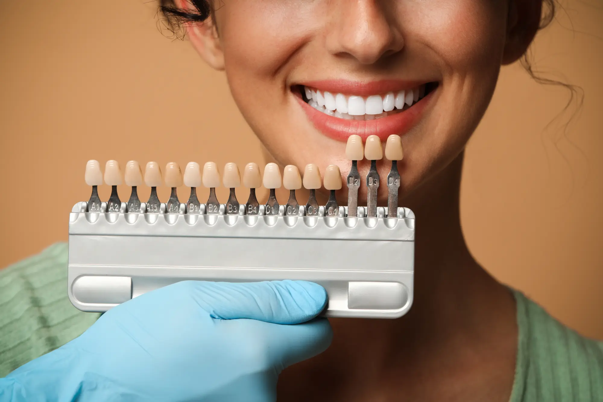 Premier Arts Dental - veneers