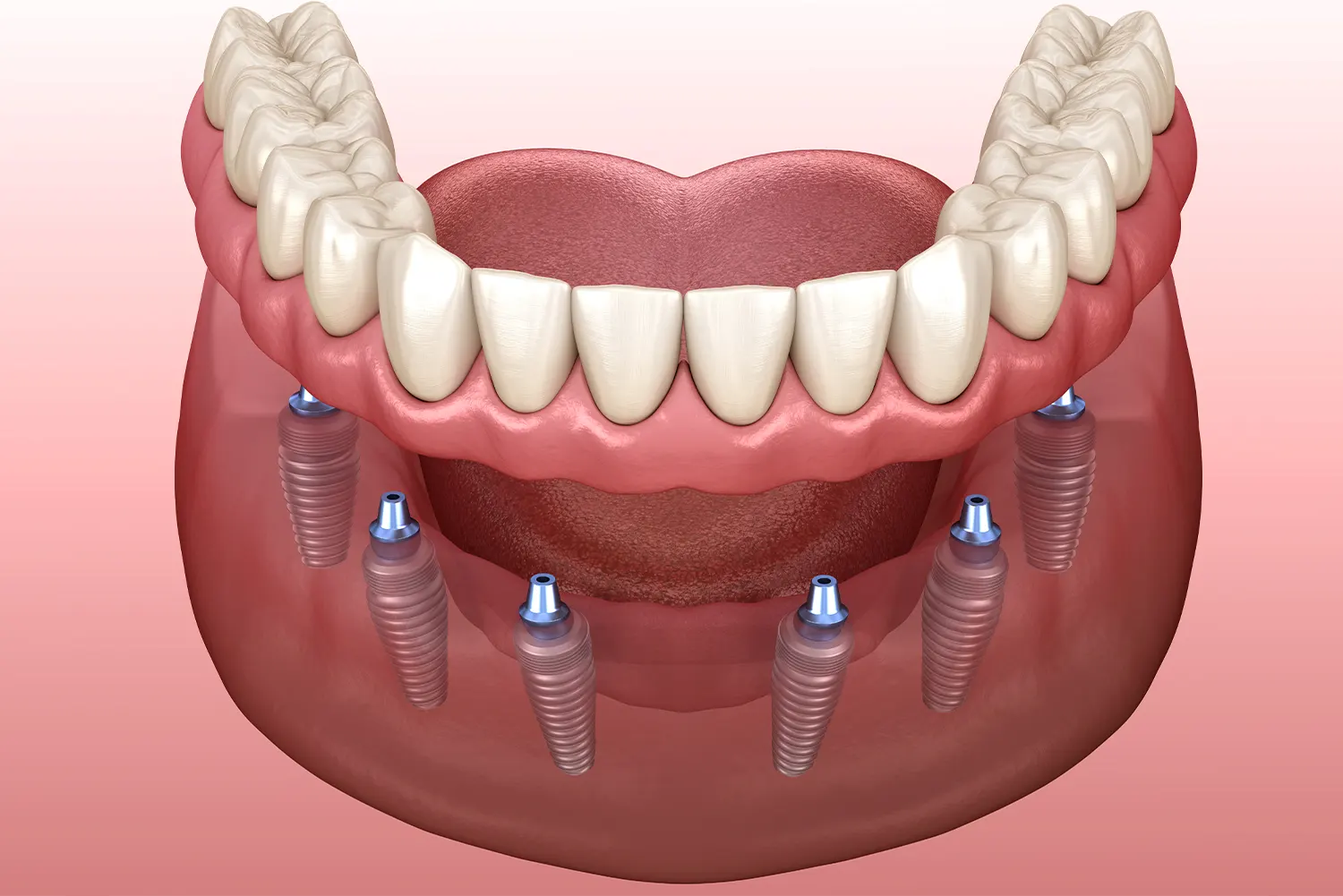 Premier Arts Dental -